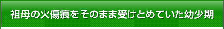 祖母の火傷痕をそのまま受けとめていた幼少期